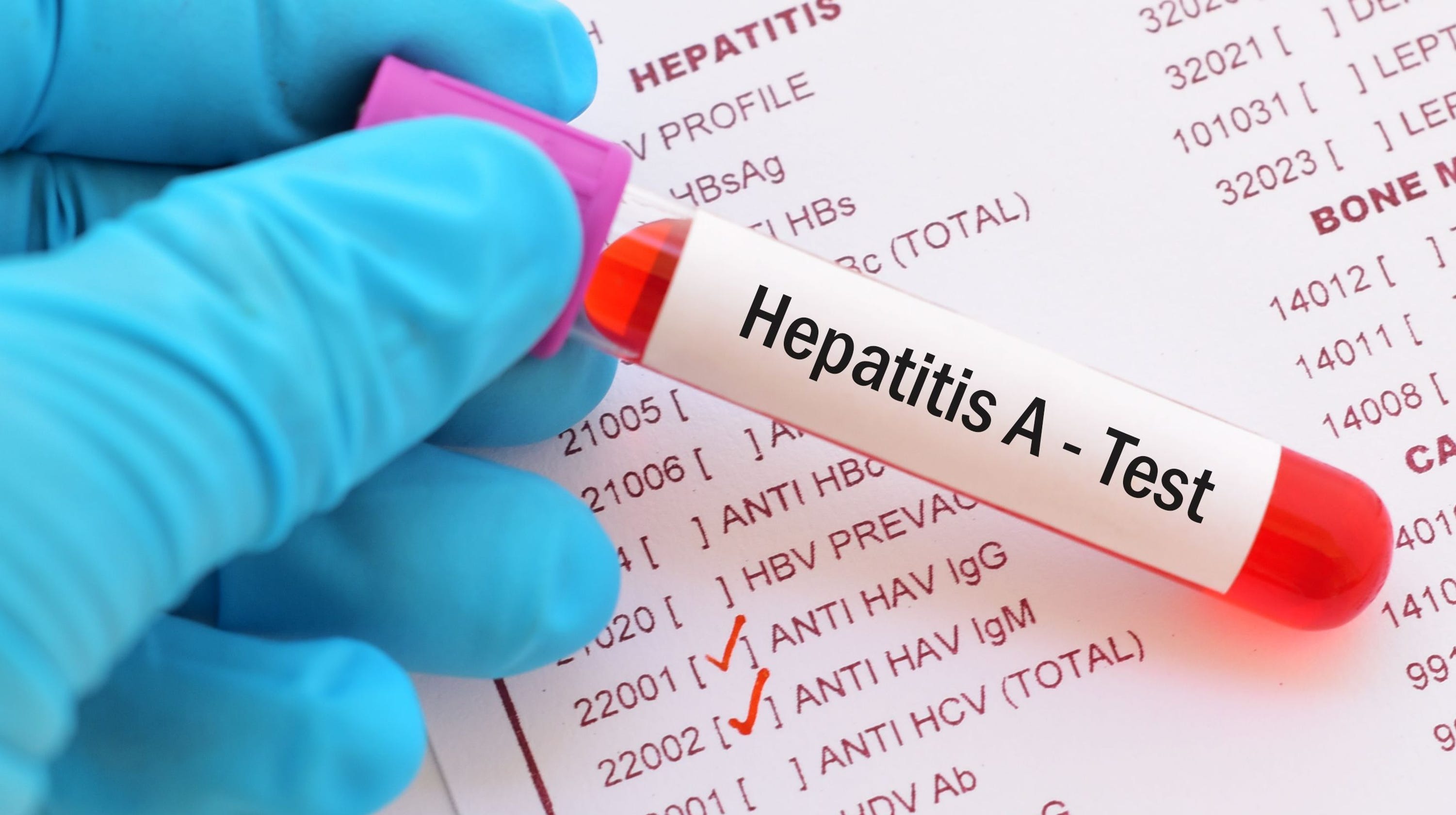 7 Arizona counties are facing Hepatitis A outbreak