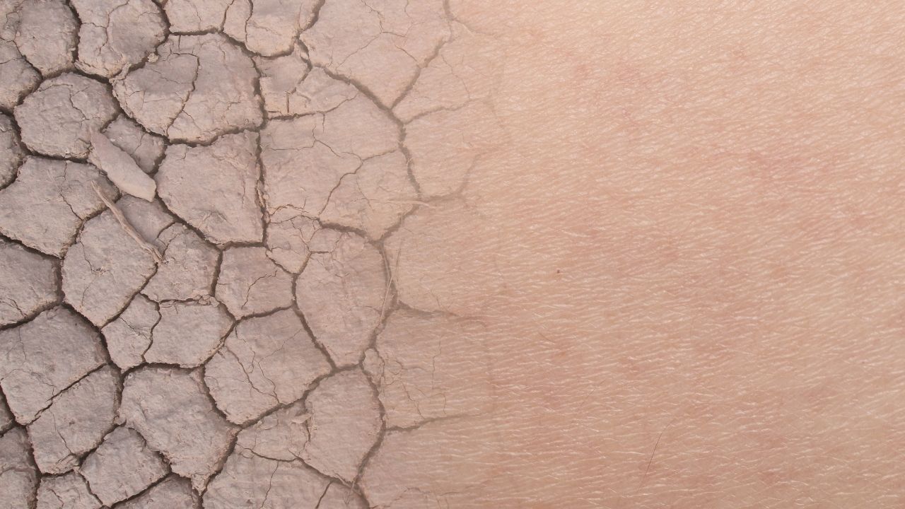 Top Tips To Help Battle Dry Skin with Grahams Natural