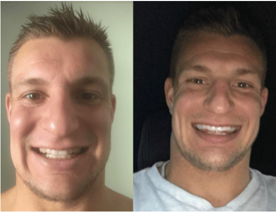 Floyd Mayweather and Rob Gronkowski Help Teeth-Whitening Company Snow Reach New Milestones!