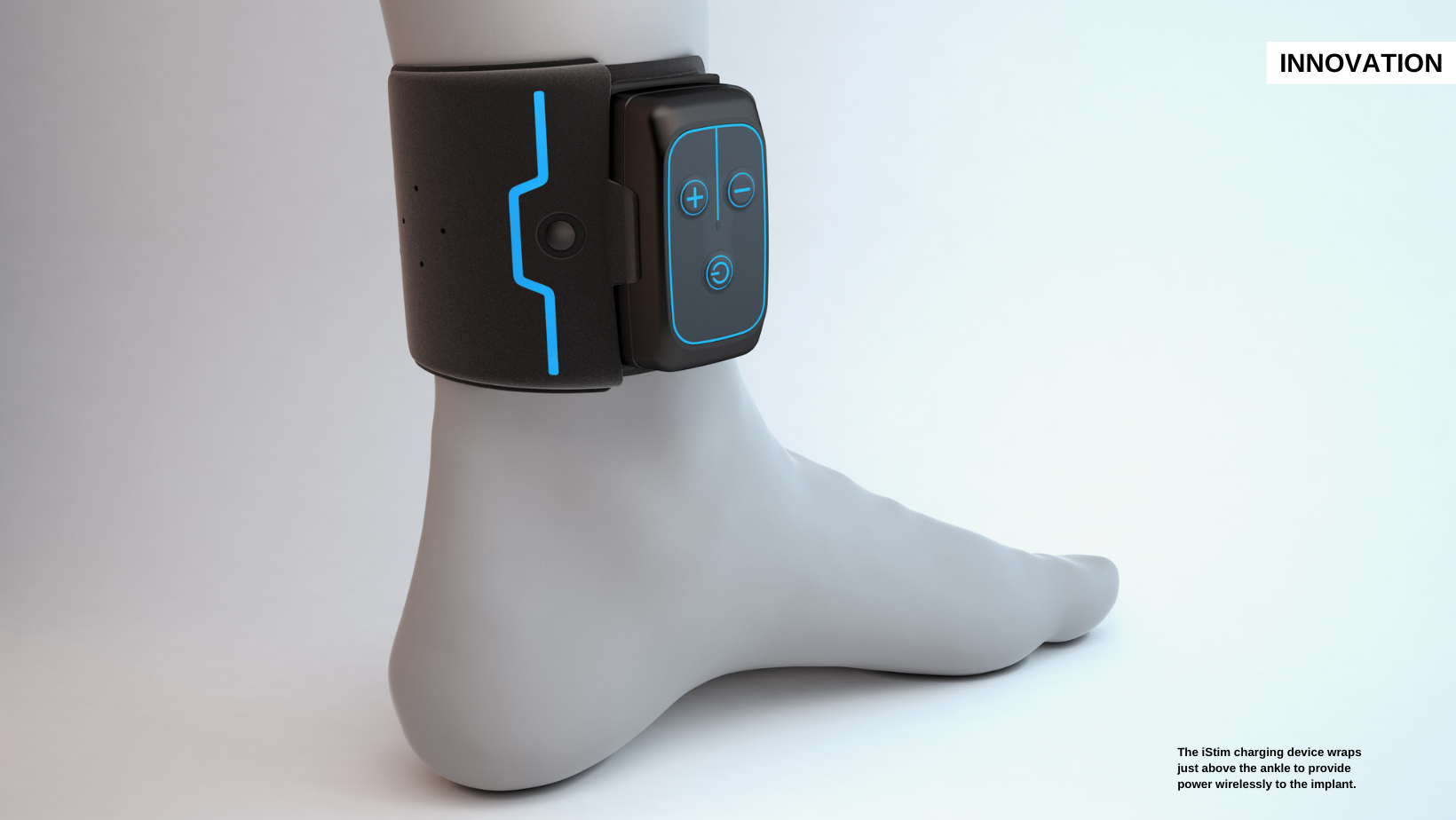 New Tech Revolutionizes Overactive Bladder Treatment