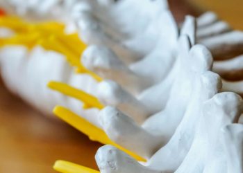 Disadvantages and advantages of spinal fusion