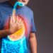 Have You Recently Taken Zantac for Heartburn? Here’s Why You Shouldn’t
