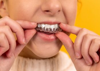 6 Efficient Procedures To Try That Will Straighten Your Teeth