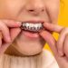 6 Efficient Procedures To Try That Will Straighten Your Teeth