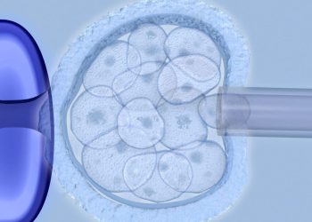 Embarking on Parenthood with Dr. Ian Hardy: A Comprehensive Exploration of Assisted Reproductive Technologies (ART)