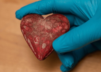 Shamini Parameswaran MD Discusses the Heart and Her Role in Cardiac Surgery