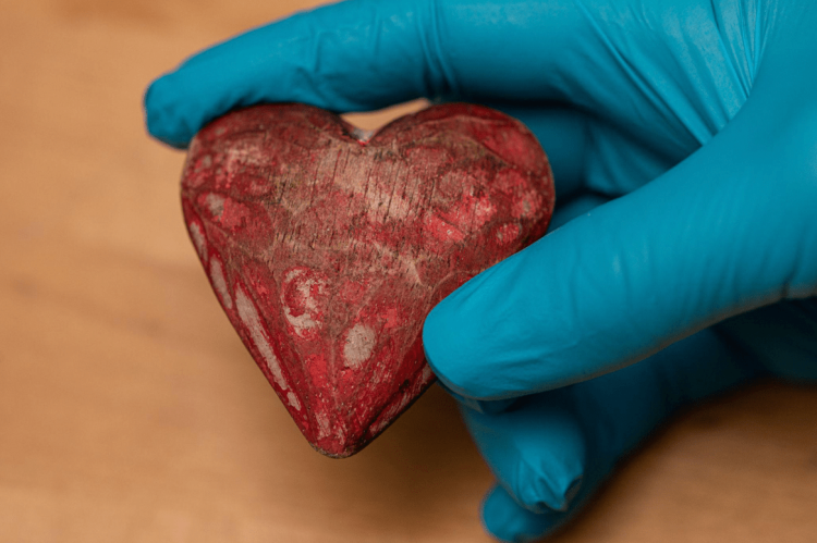 Shamini Parameswaran MD Discusses the Heart and Her Role in Cardiac Surgery