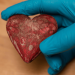 Shamini Parameswaran MD Discusses the Heart and Her Role in Cardiac Surgery