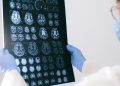 The Long Road to Recovery After a Brain Injury