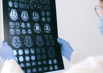 The Long Road to Recovery After a Brain Injury