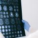 The Long Road to Recovery After a Brain Injury